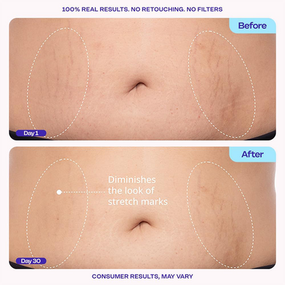 Tighten & Smooth Belly Cream, MicroTight4 Complex Body Firming Lotion for Loose Skin💜💜