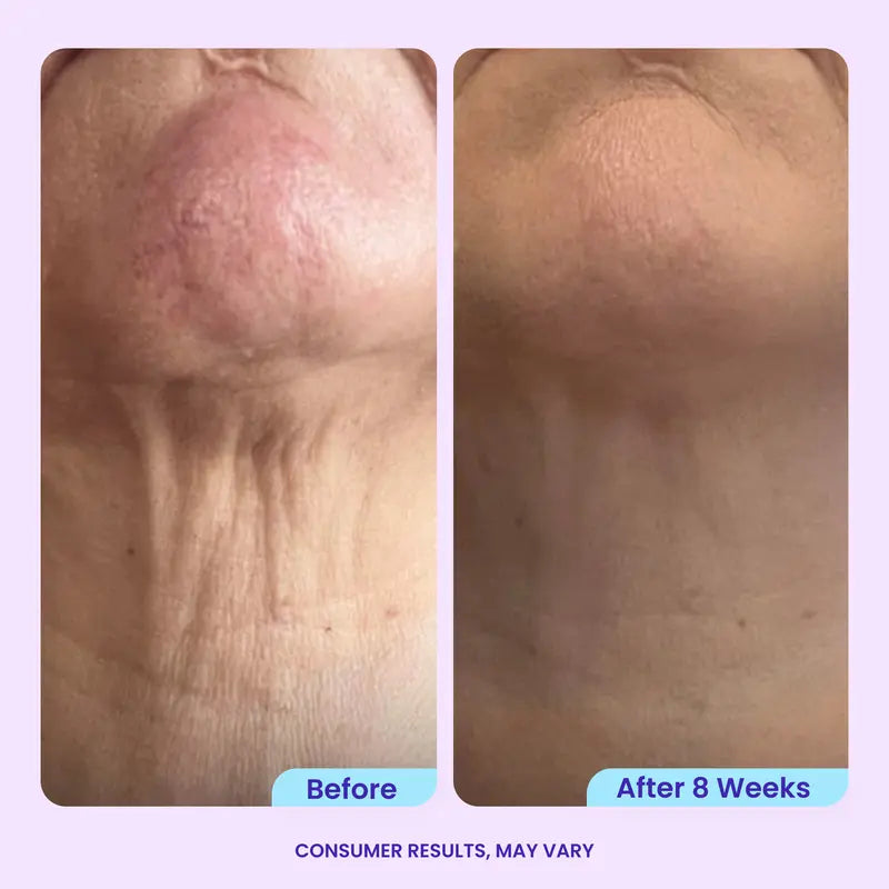 Tighten & Smooth Belly Cream, MicroTight4 Complex Body Firming Lotion for Loose Skin💜💜